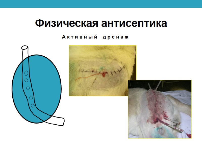 Физическая антисептика А к т и в н ы й    д